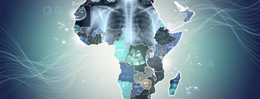 AI in African radiology